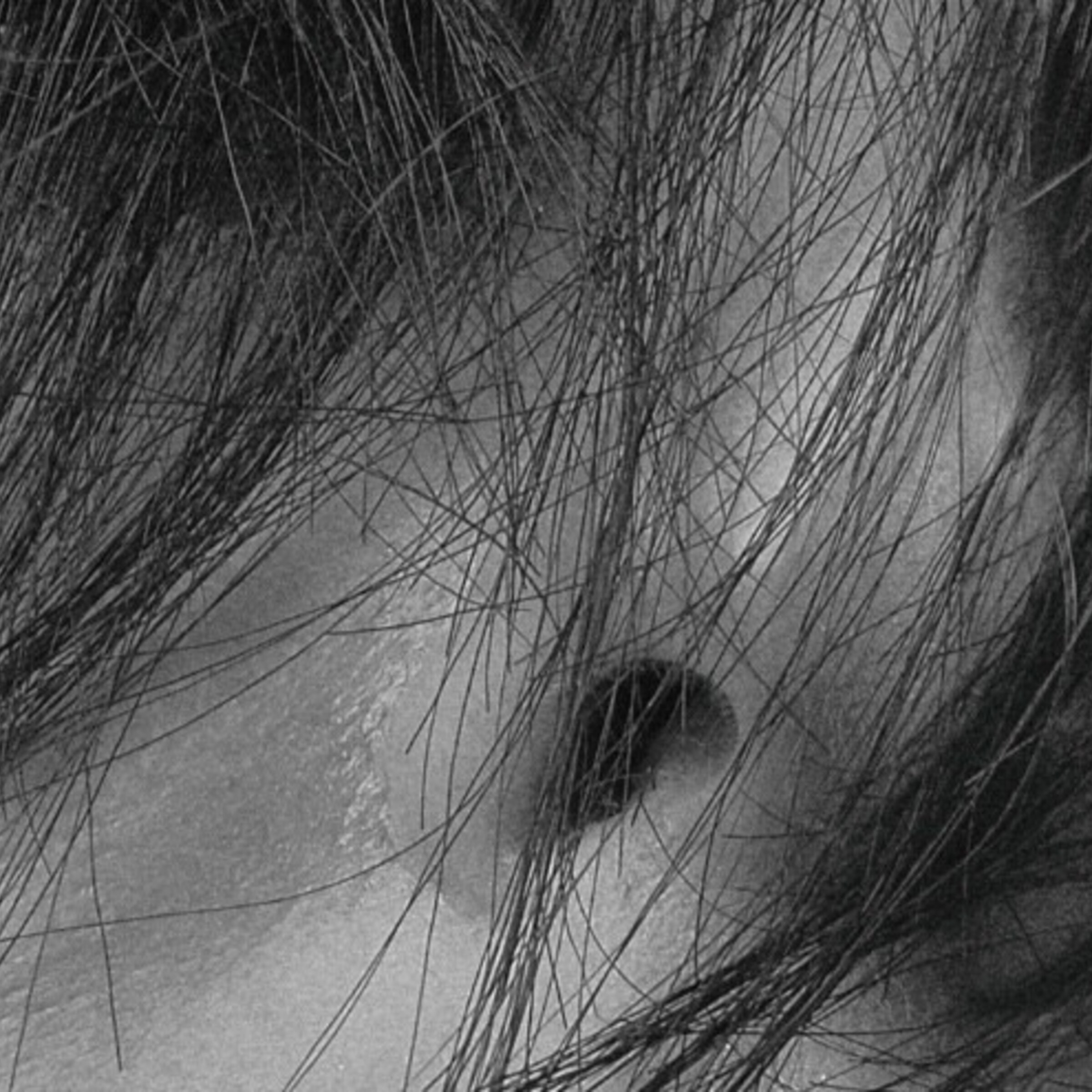 PRODUCTOS PARA CUERO CABELLUDO